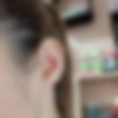 上海朝华整形医院求美者反馈