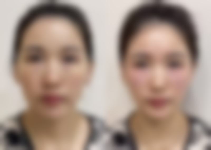 北京大学第一医院求美者反馈