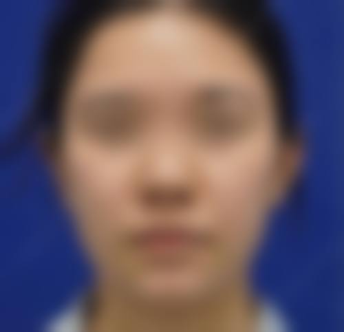 韩国明星线整形外科医院求美者反馈
