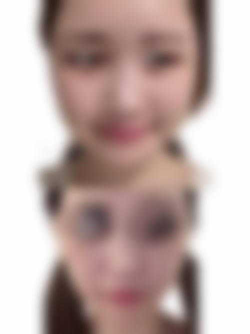 鞍山铁东区白涛医疗美容诊所求美者反馈