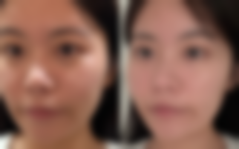 W CLINIC求美者反馈