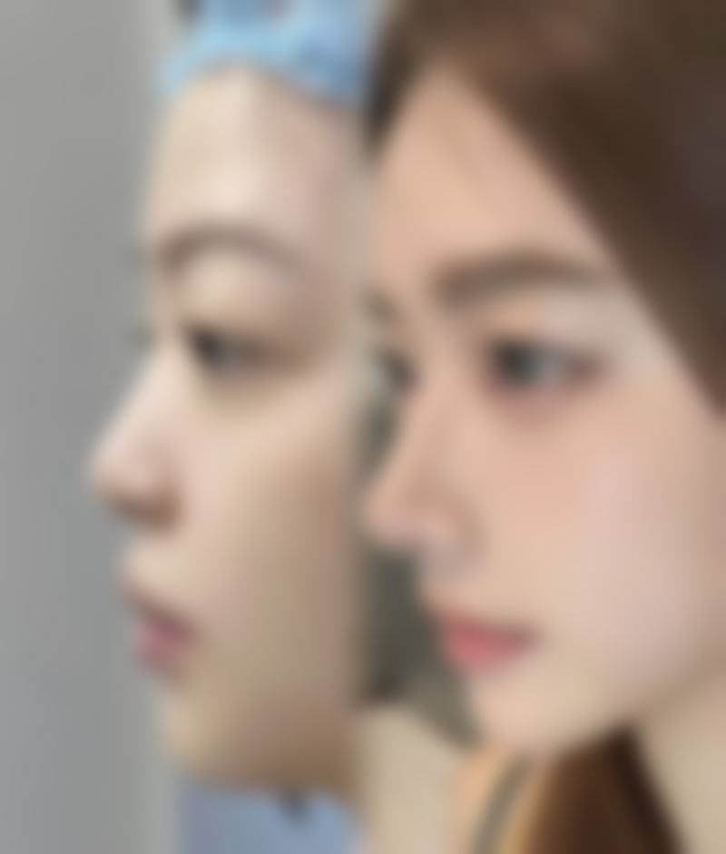 南昌爱美医疗美容整形医院求美者反馈